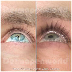 Dp Dermaceuticals Exo-Grow Lash & Brow 7ml