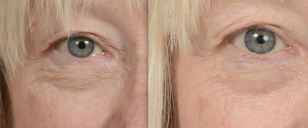 One Truth 818 Serum Serums & Correctives